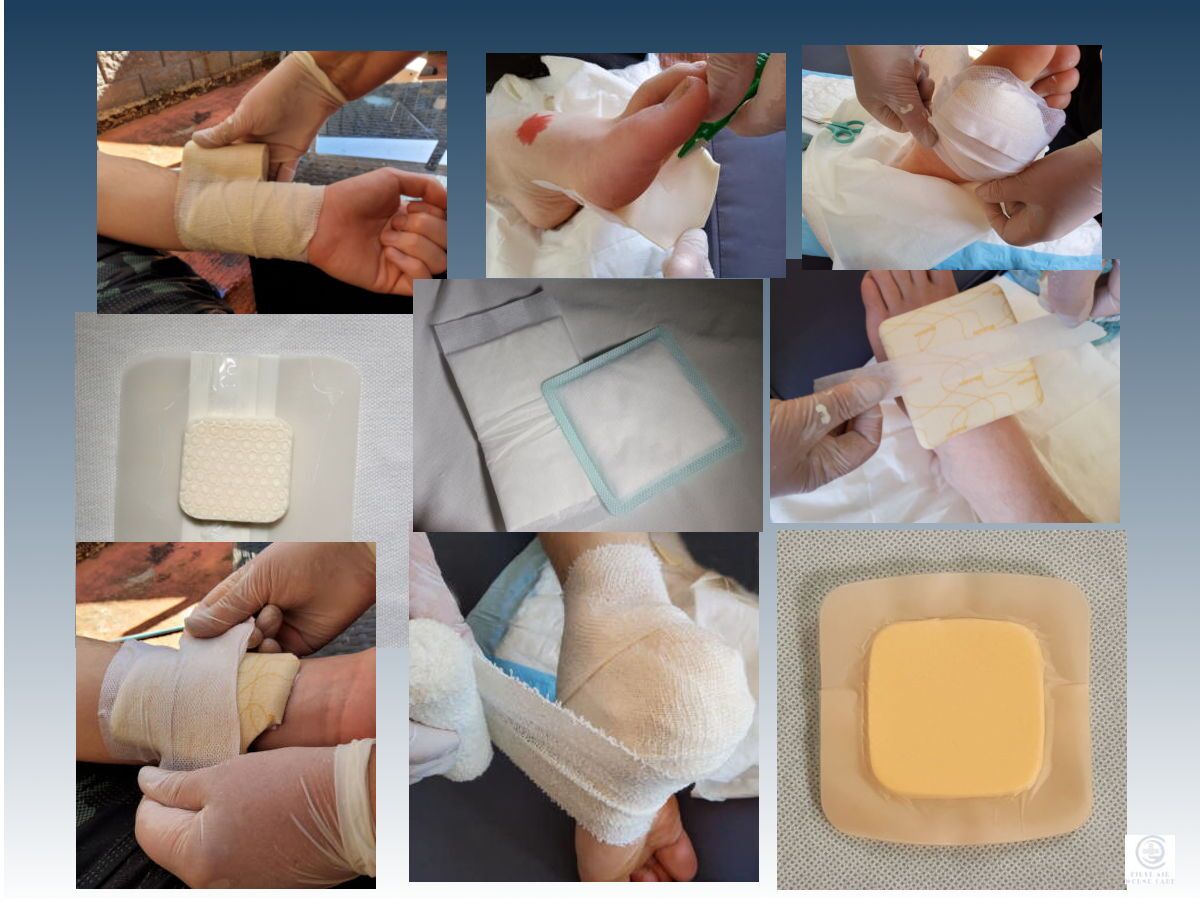 Types of dressings