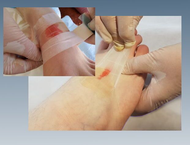 Applying comfeel