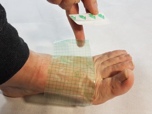 Transparent Film Dressing  First Aid Wound Care