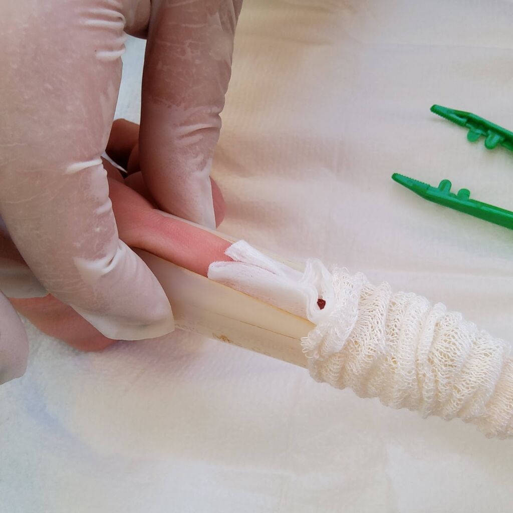 Push tubular gauze over applicator