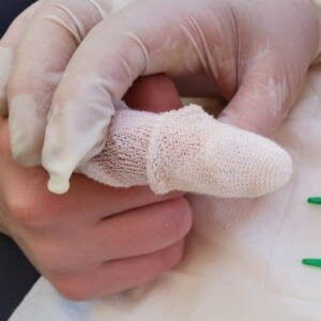 Tubular Finger Bandage With Applicator Technique First Aid Wound Care