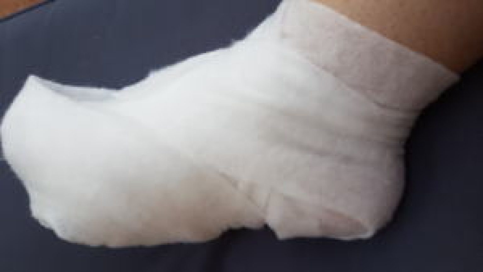 Padding For First Ray Padding Bandages – First Aid Wound Care
